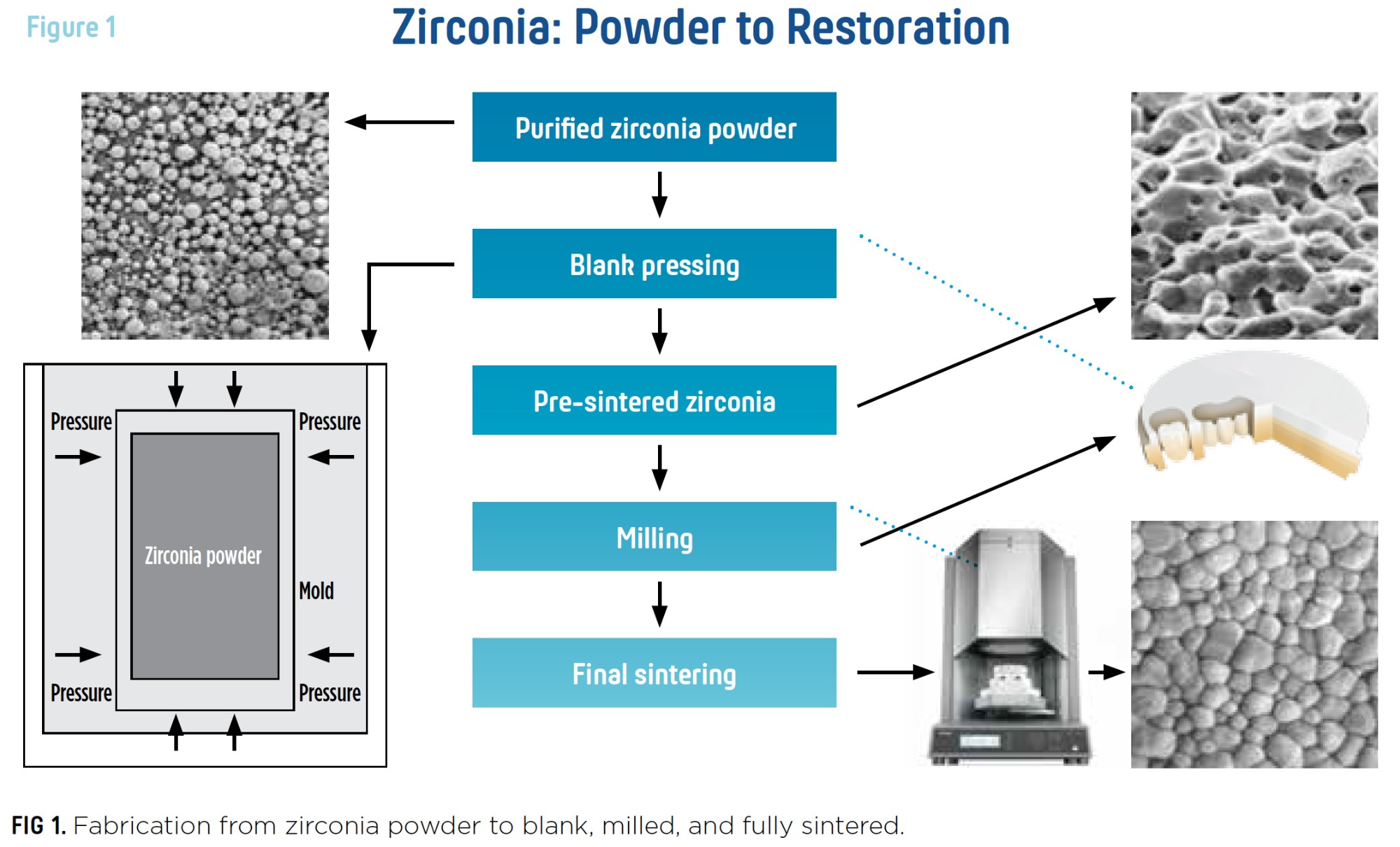 The Scientific Basis of Zirconia