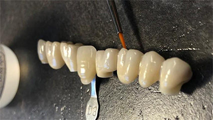 Zirconia Blocks for restoration