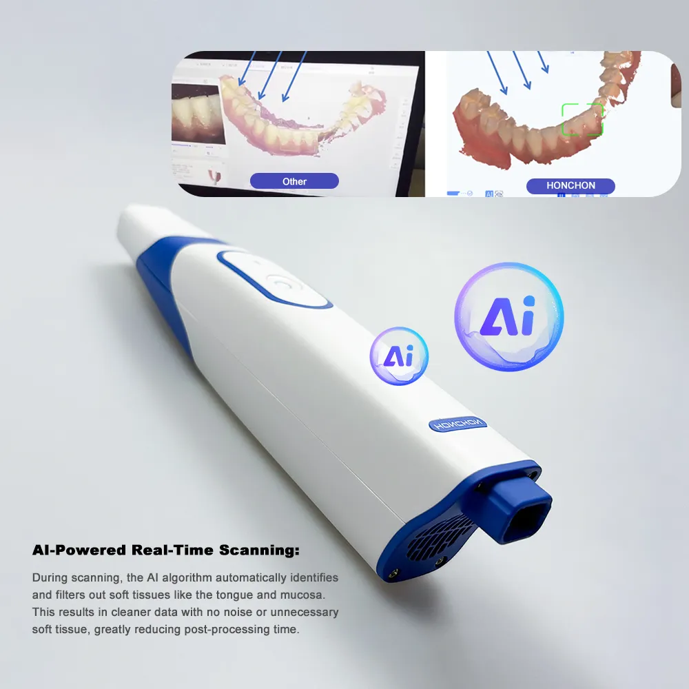 Intraoral Scanning