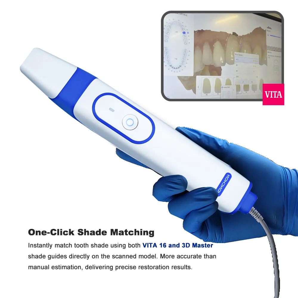 Why Your Dental Clinic Needs an Intraoral Scanner: A Game-Changer for Efficiency and Patient Care