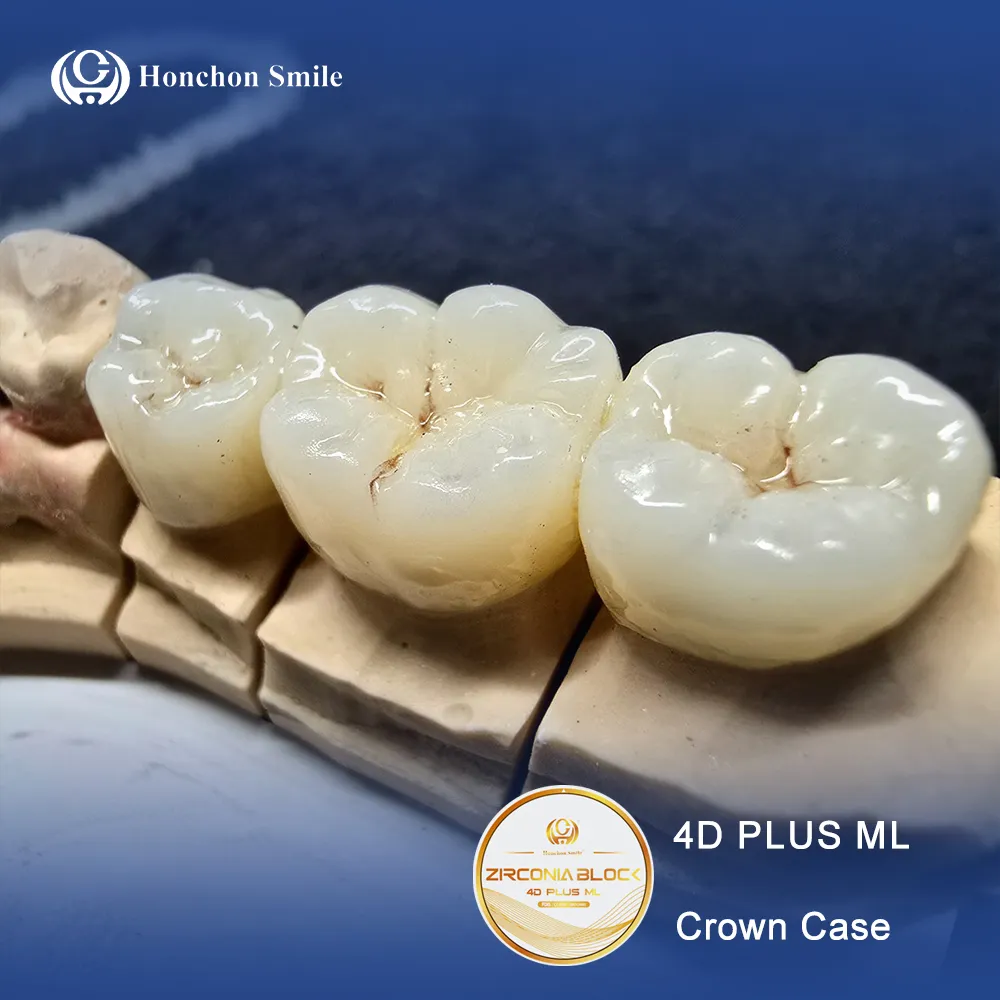 What is a Zirconia All-Ceramic Dental Crown?