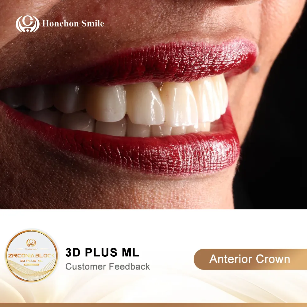 Zirconia Blocks in Dentistry: From Discovery to Future Innovations