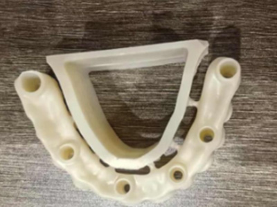 Post-Sintering Fracture Risks in Zirconia Restorations: Key Points for Technicians